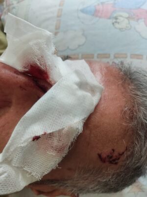 Urfa’da Kimse Sorumluluk Almıyor! Yine Köpek Saldırısı